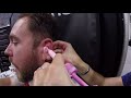 Summer NAMM 2014 - Trey Gets Fitted for some Ultimate Ears | GEAR GODS