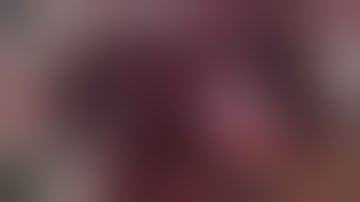 En bloc Right Tri-segmentectomy. Bismuth-Corlette Type 3A perihilar cholangiocarcinoma, Part 1