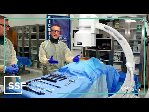 Radiofrequency Ablation - Chad Stephens, DO