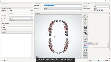 Creating an order for partial denture and full denture in Dental System