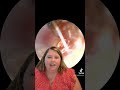 Ear wax removal