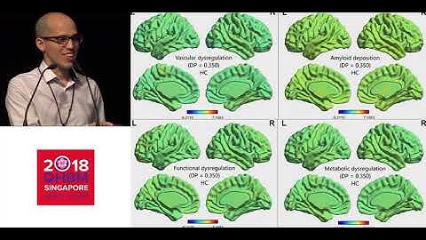 OHBM 2018 | Symposium | Yasser Iturria-Medina | Multifactorial causal modeling of neurological dis…