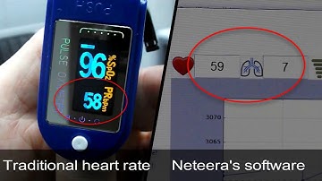 Neteera  Contact Free Vital Signs monitor  161212