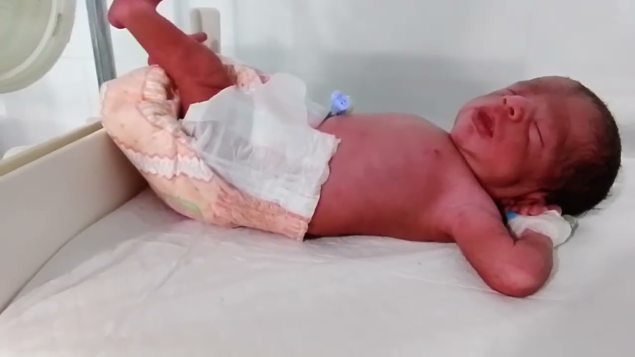 Preterm twin babies often need special NICU care because they are born early and may have low...