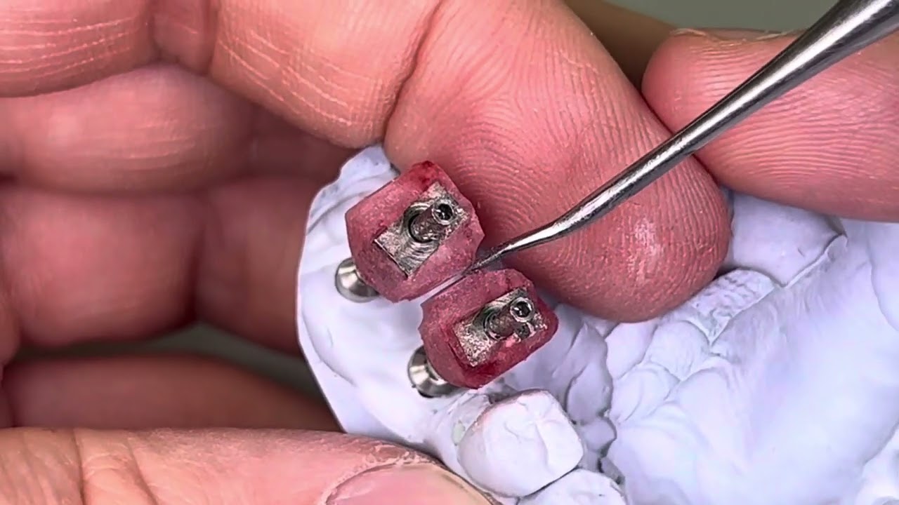 Правильно снять оттиск с уровня имплантата! Снятие слепка.