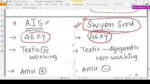 SWYERS SYNDROME - CONCEPT