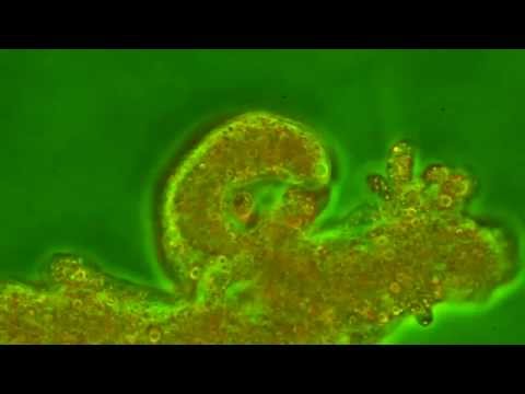 Video: Uobičajena Ameba: Struktura, Disanje, Prehrana
