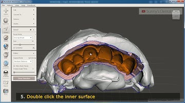 [Mesh mixer + i500] Making dental shell temporary bridges in meshmixer using scanned impression