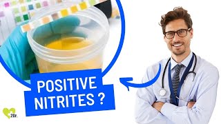 Positive Nitrites in Urine: Causes, Symptoms, and Treatments! 🚑💧