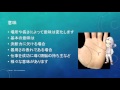 頭脳線が分かれている