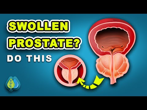 7 vitamins that SHRINK enlarged prostate naturally | enlarged prostate treatment