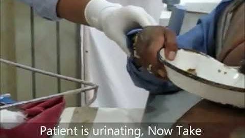 Micturating Cystourethrogram Video