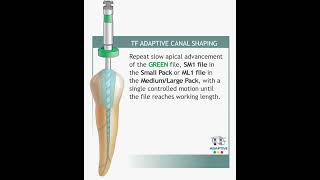 TF Adaptive NiTi Root Canal Shaping System Pinkblue