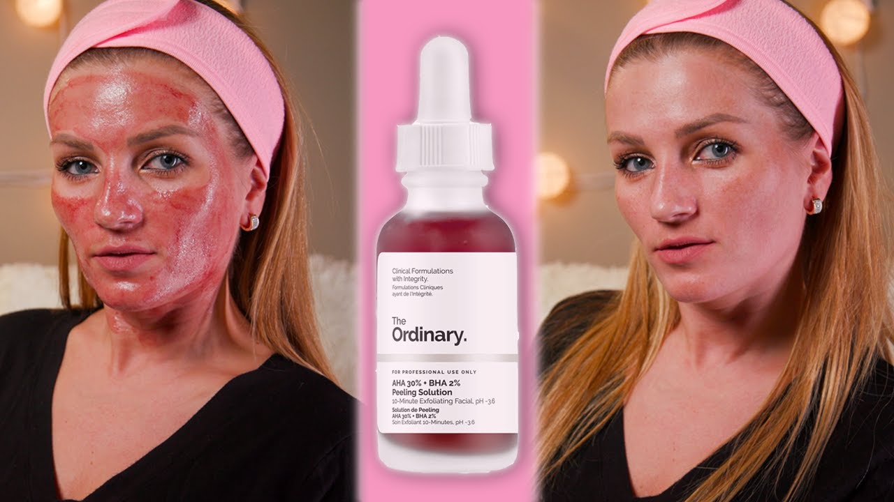 Is It Worth It The Ordinary Peeling Solution Review Demo YouTube