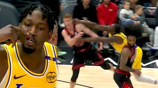 Full Heated Moment! Finney Smith Shoves Huerter After Hard Elbow Incident! 🚨 Guide