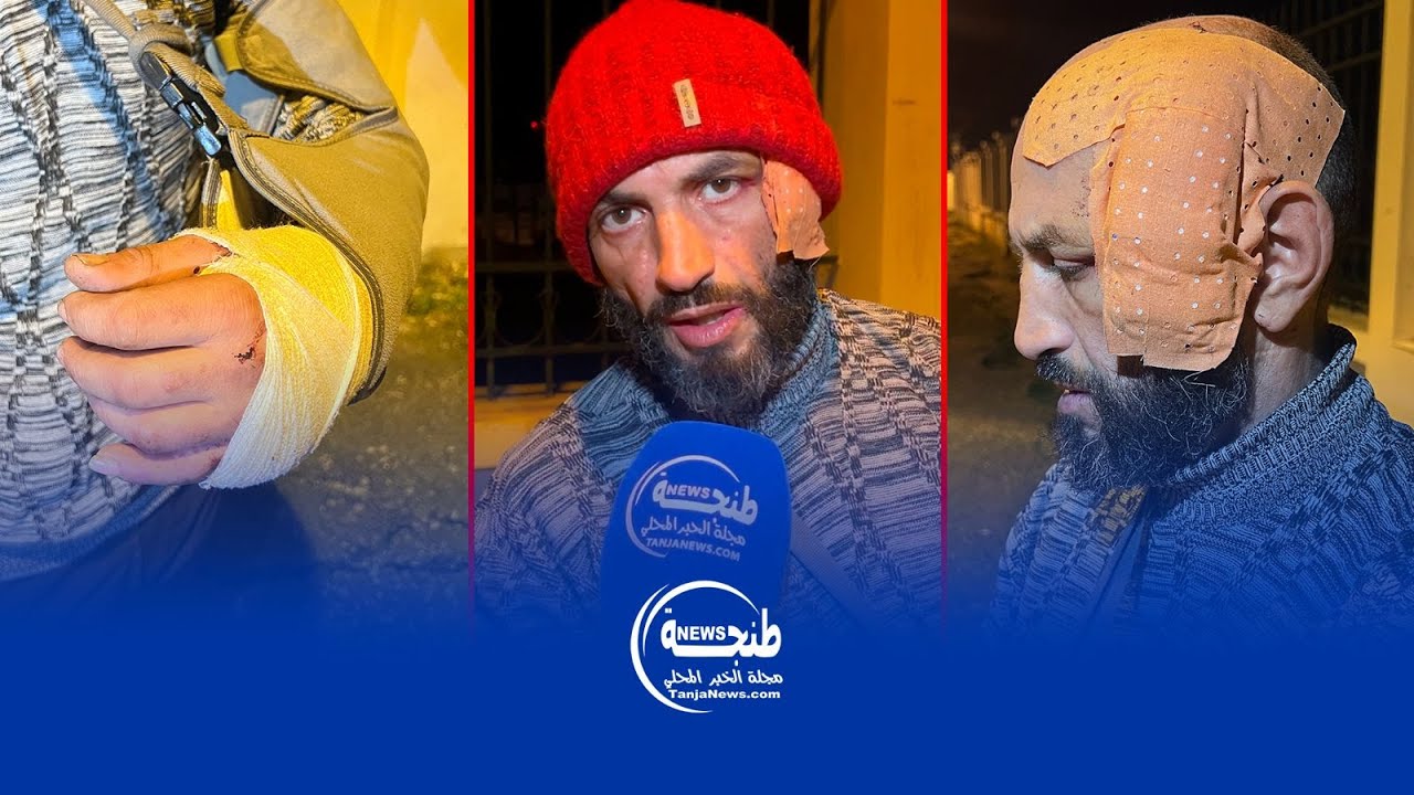 اعتداء إجرامي خطير بحي كاسبراطا.. الضحية يناشد أمن طنجة التحرك الفوري لتوقيف الجناة