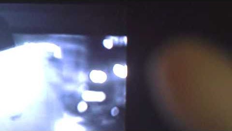 Kegel - Buddha & Bug I (La Capitale de la Douleur)