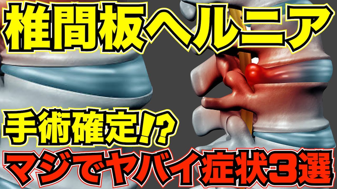 【ヘルニア患者様必見】整骨院でヘルニアは治るのか？手術の必要は？痛みや痺れに悩まれている方へ【椎間板ヘルニア】【ハートテラス整骨院】