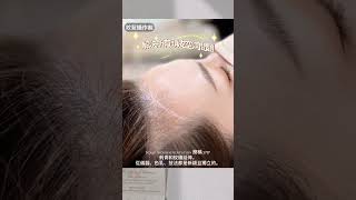 20231018 SMP髮際線