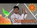 From Fun in the Sun to Painful Burns: Understanding Sunburns and Its Remedy.