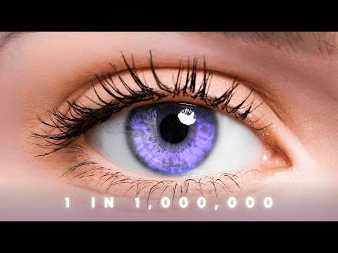 The "Forbidden" Eye Color That Shouldn't Exist