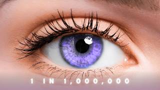 The "Forbidden" Eye Color That Shouldn't Exist