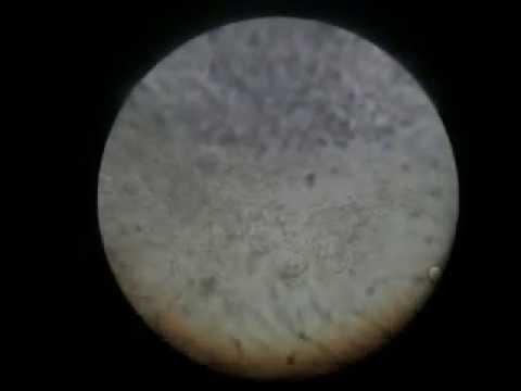 Video: Bacteriile Ucid Vacanții - Vedere Alternativă