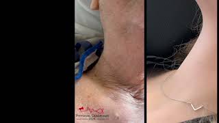 Corriganโs Pulse in Aortic Regurgitation โ Bounding Carotid Pulse Explained