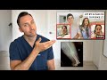DOCTOR Reacts to Marcus & Kristin’s ACCIDENT - X-ray explanation