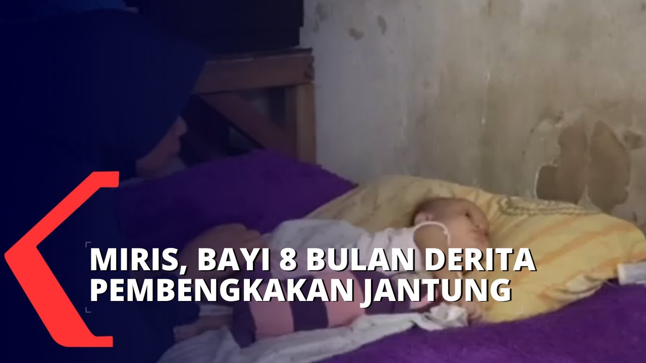 Miris, Bayi 8 Bulan di Surabaya Derita Pembengkakan Jantung dan Paru