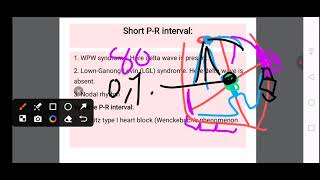 PR interval and it related problems, انتروال PR و تغیرات پتالوژیک آن #ecg #printerval#nurse 