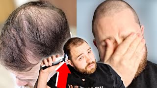 BALDING MAN DISTRAUGHT After Shaving Head BALD *Emotional*