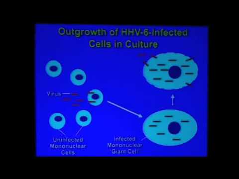 Anthony Komaroff 2/2 - Overview of HHV-6 and CFS