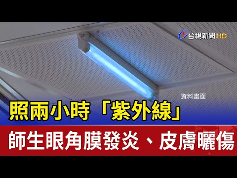 照兩小時「紫外線」 師生眼角膜發炎、皮膚曬傷