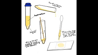 URINALYSIS explained: created for veterinary technicians and nurses