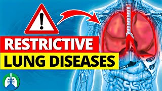 13+ Restrictive Lung Diseases (Listed & Explained) 🫁