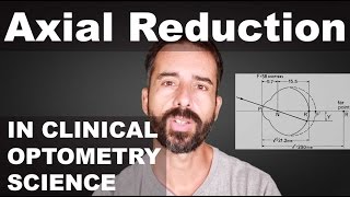 Adult Reduction In Eyeball Axial Length - Emmetropization Mechanism? | EM | Reduced Lens Method ™