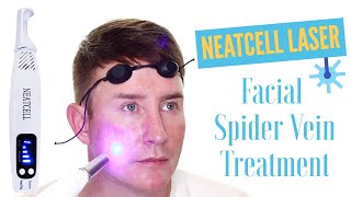 Neatcell Picosecond Laser Spider Vein Treatment | TJtutorials