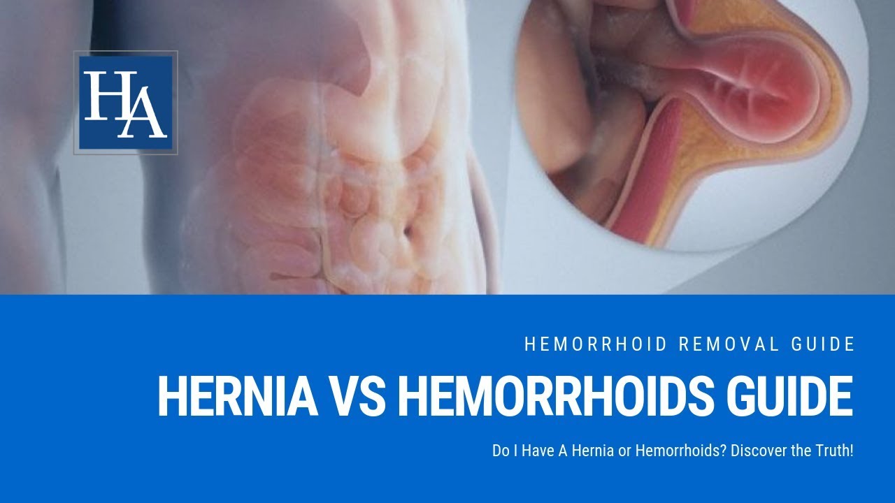 Hernia vs Hemorrhoids Guide Do I Have A Hernia or Hemorrhoids