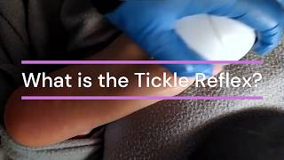 Why Are We Ticklsh? Analyzing Human Laughter Therapy & Sensory Experiment Triggers