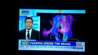 CNN Dr. Gupta UCLA Brain mapping Research