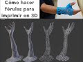 Cómo elaborar Férulas con impresión 3D (parte1)