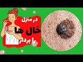 از بین بردن خال با روغن کرچک معجزه ی برداشتن خال ها با روغن کرچک 