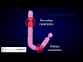 STRUCTURE OF CHROMOSOME