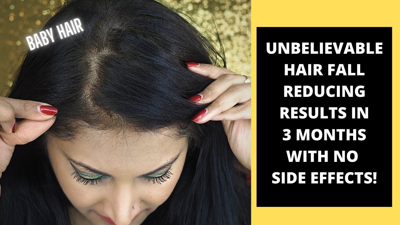 Fantastic hair fall reducing results in 3 months & increase growth for
