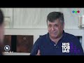 Carmen, de una BACTERIA LETAL a vivir un TRASPLANTE de CARA - Historias únicas en #TelefeNoticias