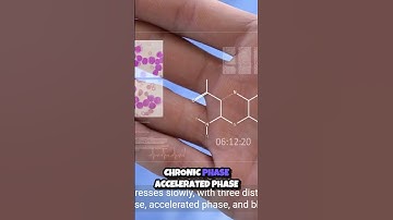 Unraveling CML  The Journey Through Chronic Myeloid Leukemia 📚