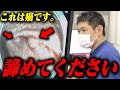 「この癌は必ず再発します。」医師が伝えた患者への宣告に「どうすればいい?」不安な言葉に対し医師からのアドバイスは...