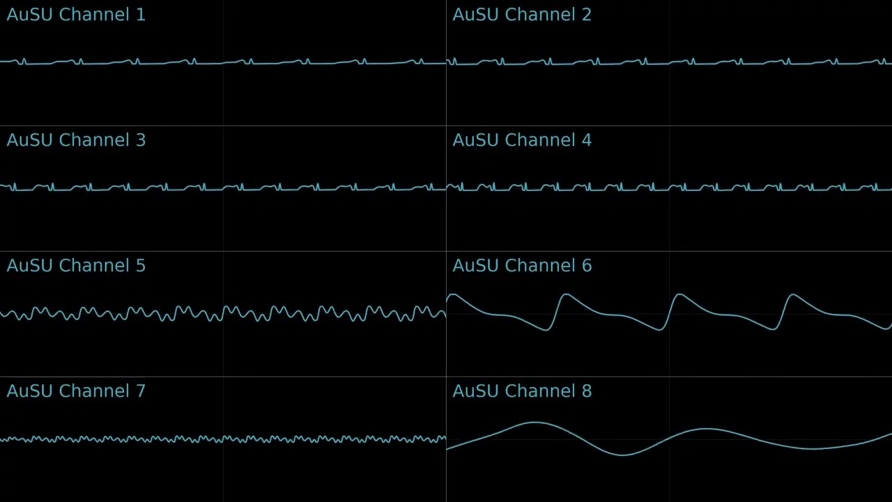Vilkomenn! (SN7 Original by Crisps) [AuSU Cover by Soggy Music]
