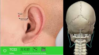 TC22 N AURICULAR MAYOR
